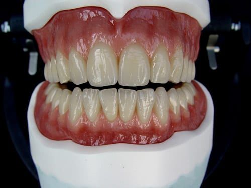 Постановка полных съемных протезов. Постановка полных съемных протезов. Моделировка десны верхняя челюсть. Моделировка десны верхняя челюсть. Полный съемный пластиночный протез (с импортными зубами германия).