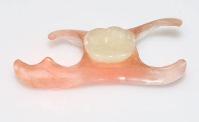 Частичные съемные протезы зубов - какие бывают и кому подходят