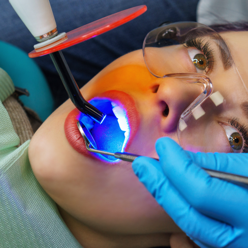 Восстановление зуба для последующего протезирования СИЦ+фотополимер