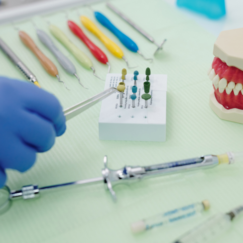 Временное восстановление стенки зуба (эндодонтия)